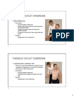 Thoracic Outlet Syndrome: - Adson Maneuver