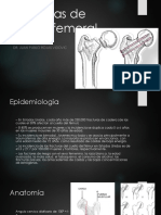 Fracturas de Cuello Femoral