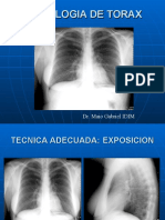 Radiologia de Torax Udh