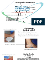 CRIOTERAPIA