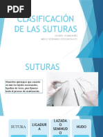 Clasificacion de Las Suturas