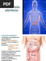 Patologías Gástricas