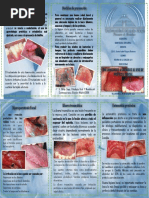 Enfermedades Asociadas Al Uso de Prótesis Dental