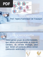 Miocardiopatás