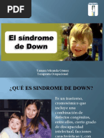 Sindrome de Down