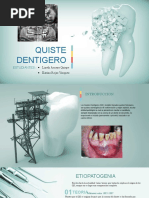 Quiste Dentigero