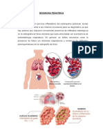 Neumonia Pediatrica