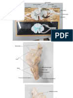 Prática Completar Tronco e Medula