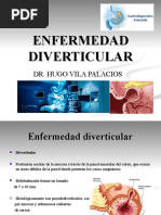 Enfermedad Diverticular