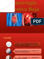 Hemorragía Digestiva Baja