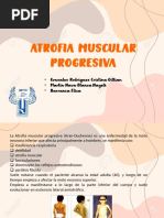 Atrofia Muscular Progresiva