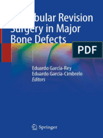 Acetabular Revision Surgery in Major