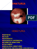 Hematuria