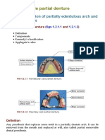 Removable Partial Denture