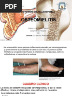 Osteomielitis Proyecto Final