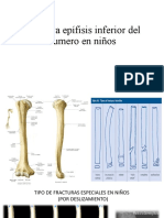 Fractura Epífisis Inferior Del Humero en Niños - Cajas Montenegro