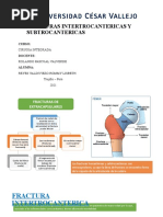 Fractura Intertrocanterica y Subtrocanterica. Reyes Valdiviezo Rommy