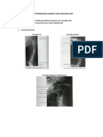 Laporan (Os - Humerus Dan Shoulder)