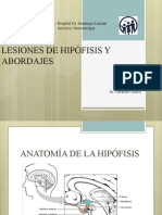 Lesiones de Hipófisis y Abordajes