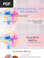 Hemorragias de 2 y 3 Trimestre-1