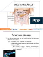 Tumores Pancreáticos