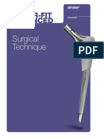 Secur-Fit Advanced: Surgical Technique