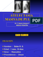 Caso Atelectasia