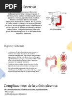 Colitis Ulcerativa