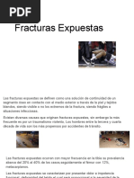 Fracturas Expuestas