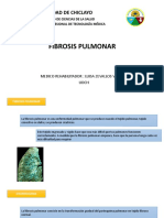 Fibrosis Pulmonar UDCH