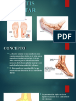 Fascitis Plantar