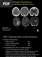 2-Tumores Cerebrales Diploma TC