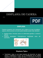 Displasia de Cadera