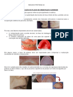Resumo Prótese Total