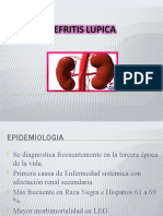 Nefritis Lúpica