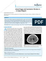 Simultaneous Hemorrhage and Ischemic Stroke in The Same Brain: A Case Report