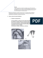 Anestesia Infiltrativa