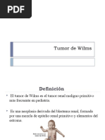 Tumor Wilms