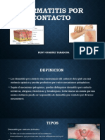 Dermatitis Por Contacto