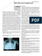 Case Report: A Child With Acute Lymphocytic Leukaemia: R Bonanthaya, L.Appaji and K.C.Lakshmaiah