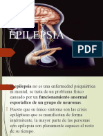 Epilepsia 2