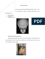 Tecnica Posteroanterior de Waters