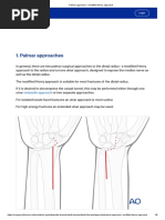 Palmar Approach - Modified Henry Approach