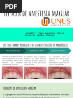 Técnica de Anestesia Maxilar