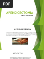 APENDICECTOMIA