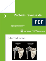 Protesis Reversa Hombro