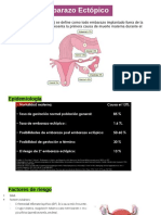 5 Embarazo Ectopico