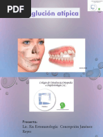 Deglucion Atipica