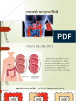 Colita Ulcerativă