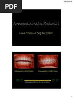 Armonización Oclusal